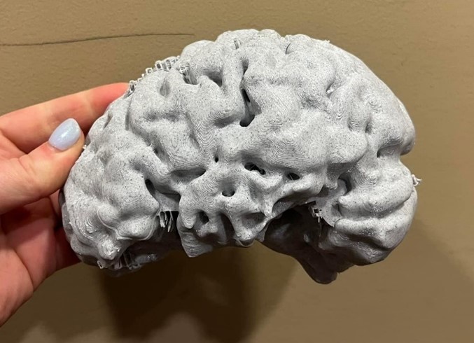 An image of a 3D printed brain segment 