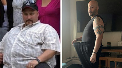 Dave Sousa, before and after bariatric weight loss surgery.