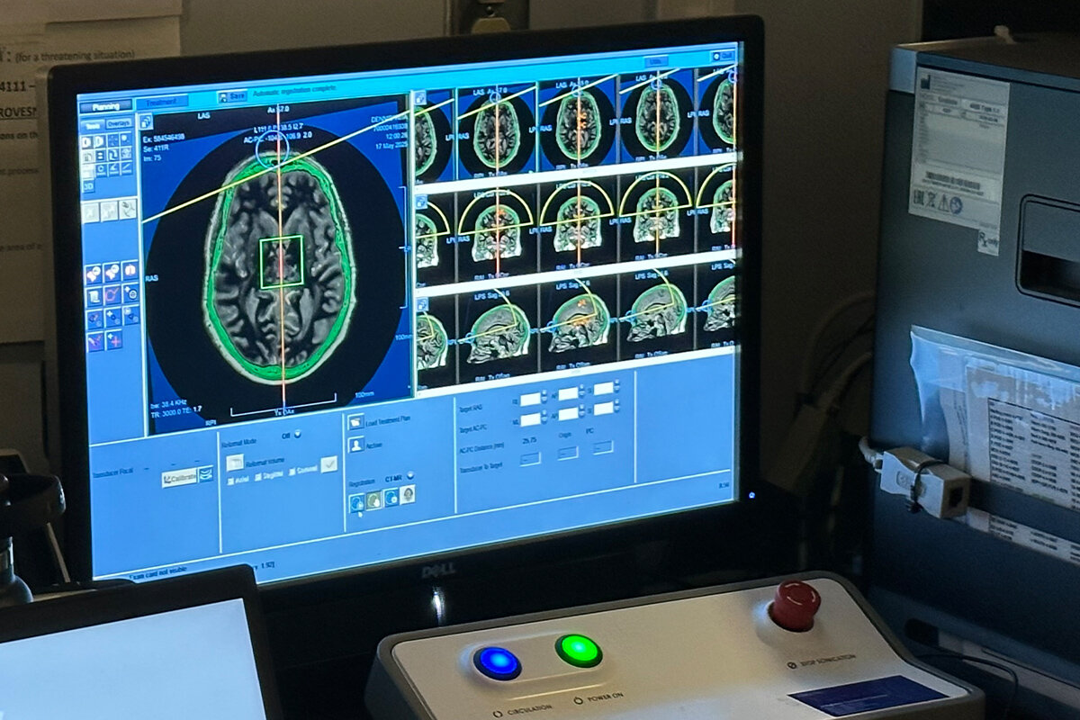 Scans of Rita Dennis's brain