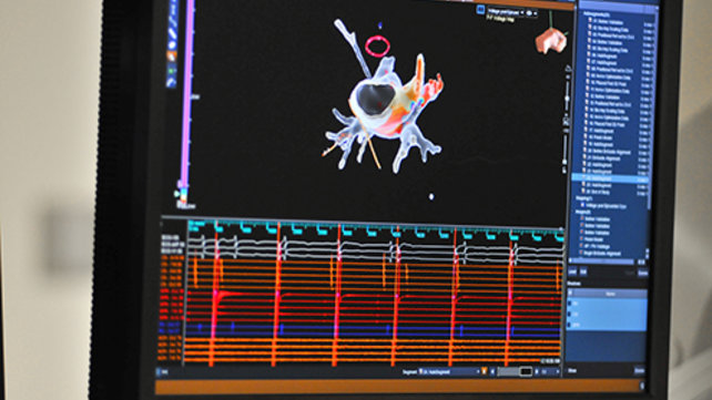 Computer imagery of someone's heart