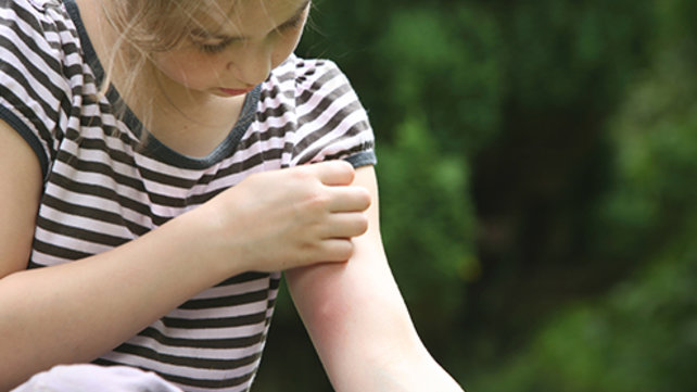 Child with an insect bite