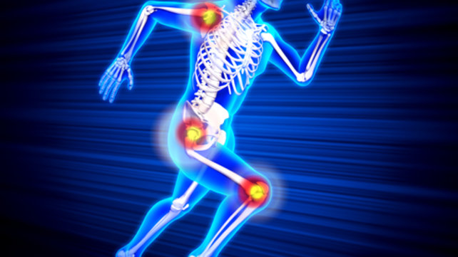 A diagram of human joints