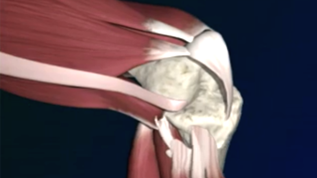 Knee animation still