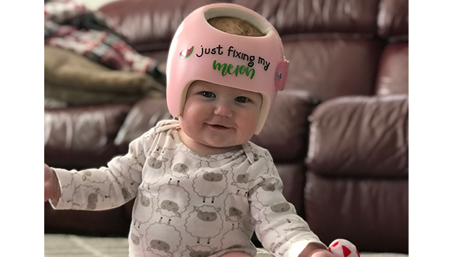 baby wearing a protective helmet