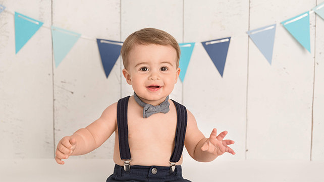 Infant with Coronal Synostosis after surgery repair.