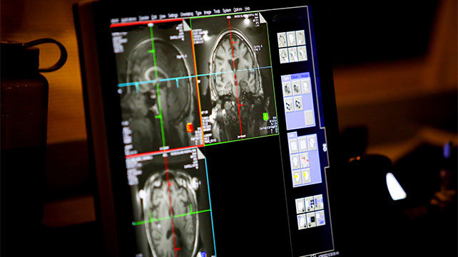 Medical imaging of a human brain