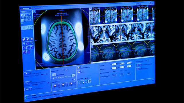Medical images of the brain.