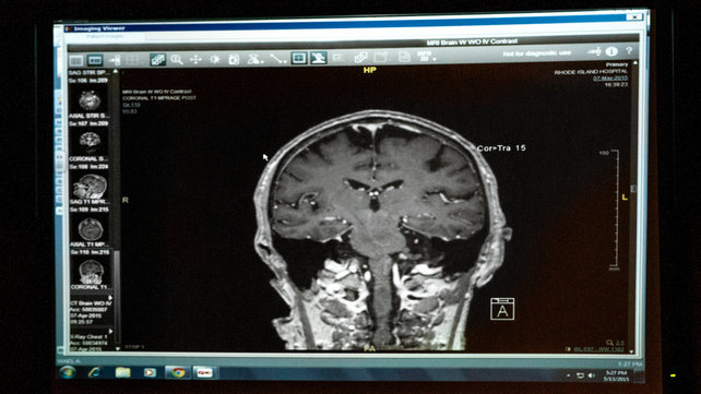A brain scan