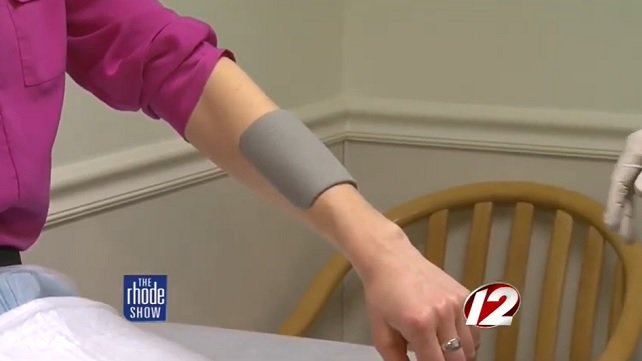 Woman having her arm bandaged for a burn