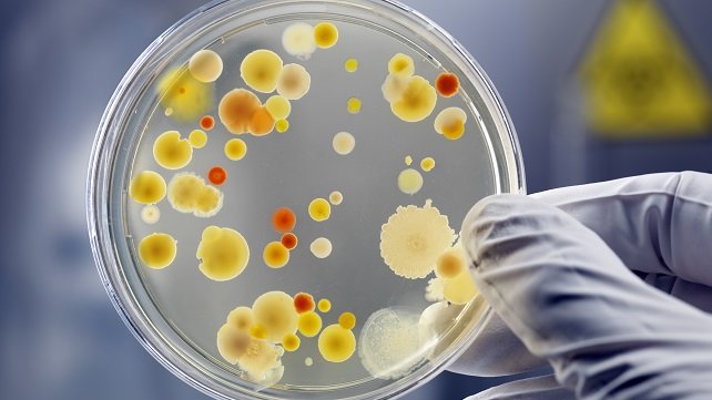 CLose up of a hand holding a culture in a petri dish