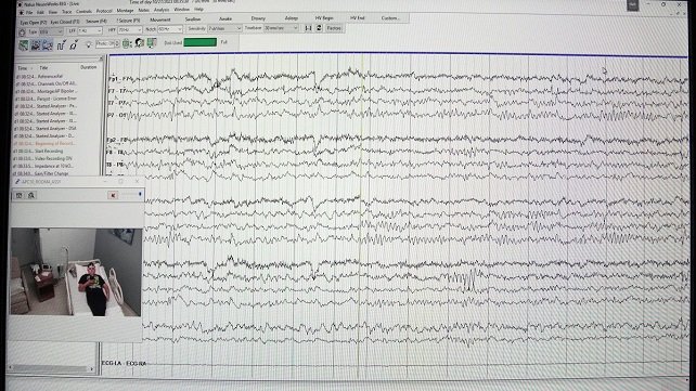 While you are sleeping, our EEG technicians are quietly monitoring your test on their computers.
