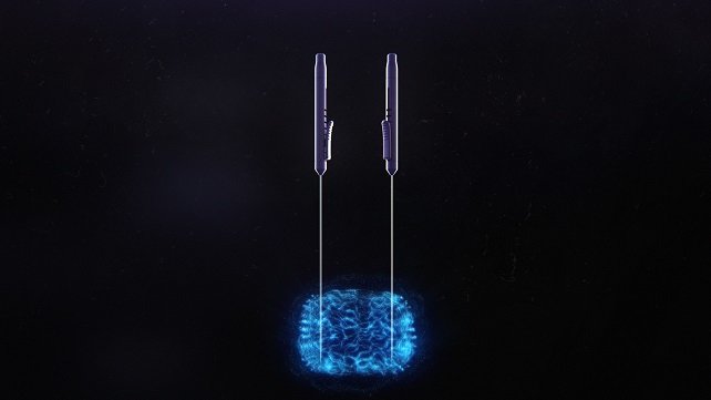 NanoKnife photo probe imagery