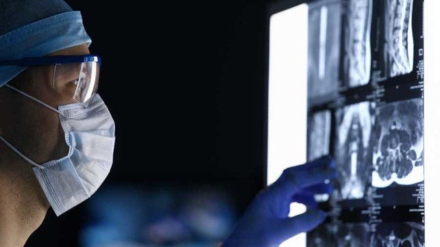 Doctor looking at spine xrays