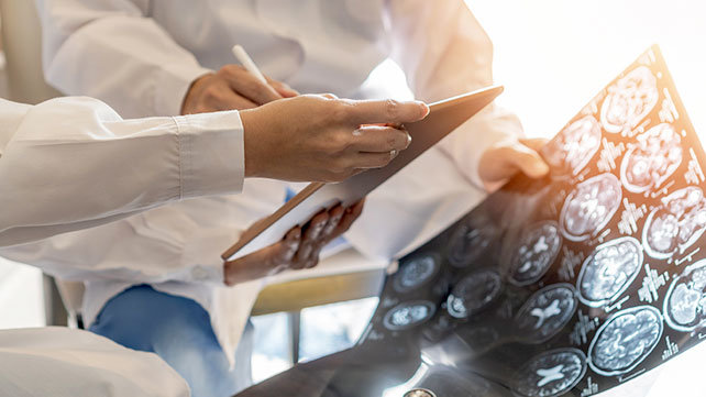 Doctors looking at neural scans on a computer