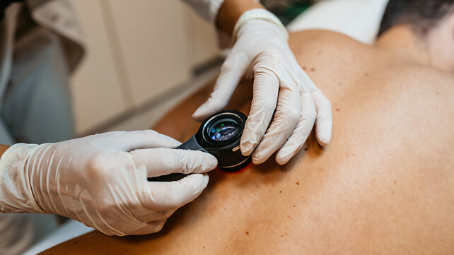 A patient lying on their stomach, while a clinician examines the skin on the patient's back.