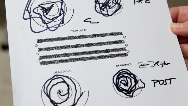 A piece of paper with spiraling lines drawn on the top and bottom. The top circles show more variation in the steadiness of the line, and were made before a focused ultrasound treatment. The bottom circles are more uniform and were drawn after a focused ultrasound treatment.